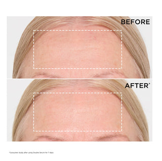 Clarins Double Serum Antiedad para Rostro