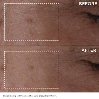 Clarins Double Serum Antiedad para Rostro